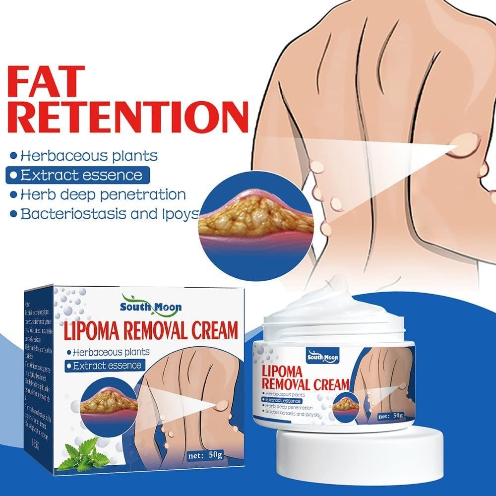 South Moon Lipoma Removal And Body Smoothing Cream