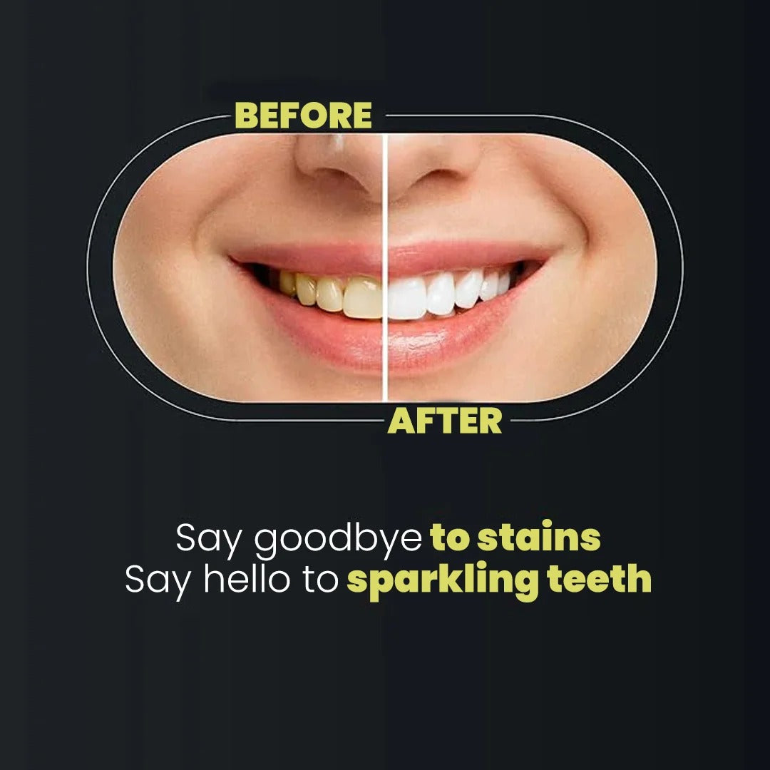 Teeth Whitening Strips 9D Advanced 14 Strips