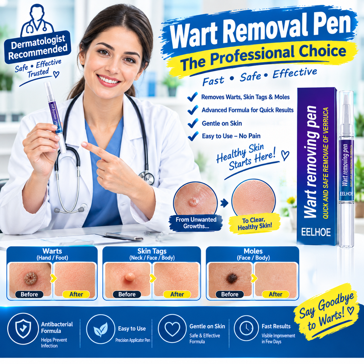 Wart Remover Gel Pen – Targeted Wart Treatment for Hands & Feet