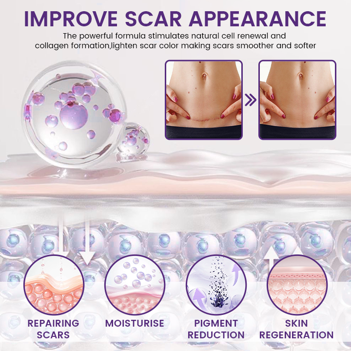 Timilk REGENSCAR Stem Cell Scar Gel